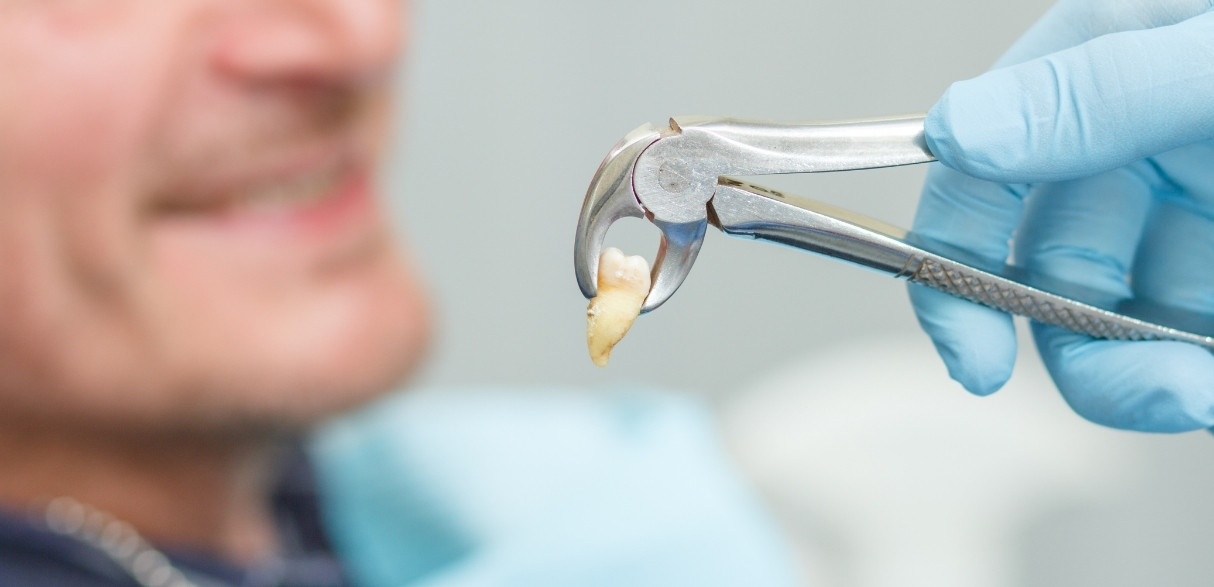 managing pain and swelling after wisdom tooth extraction