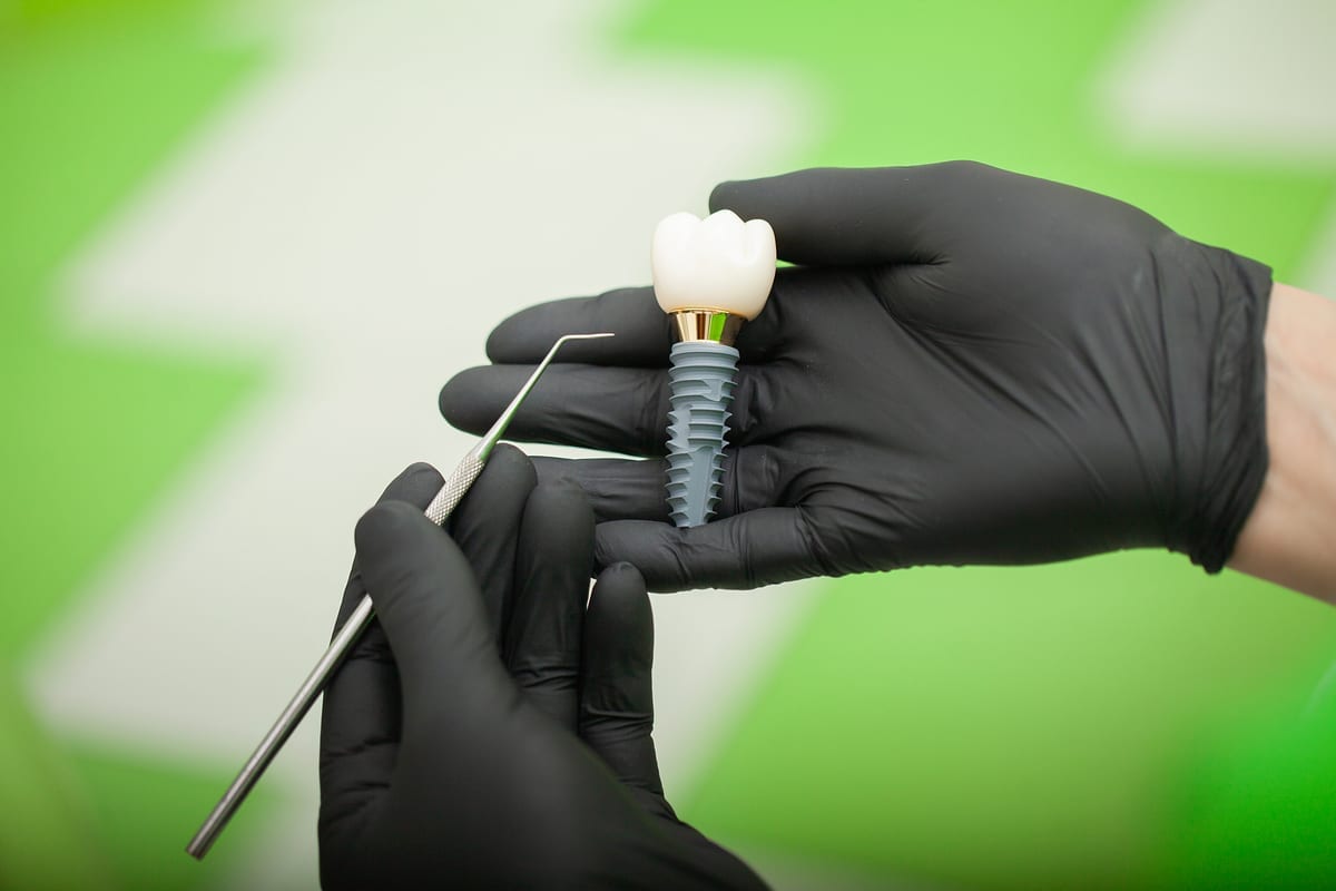 Dental Implants in San Jose